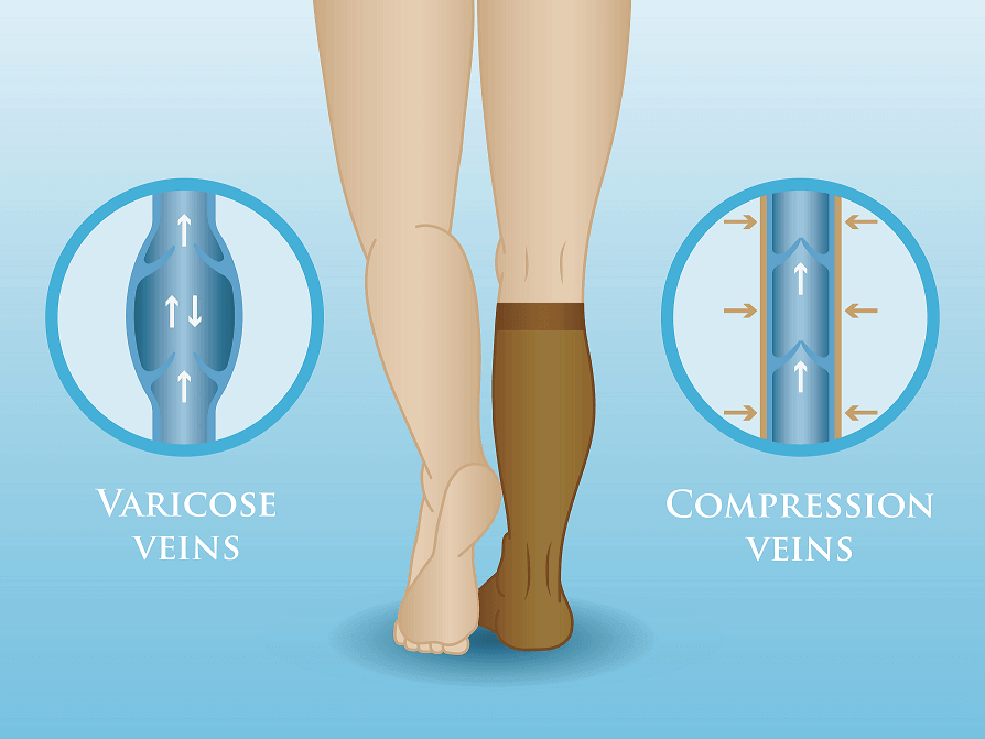 how does compression socks work